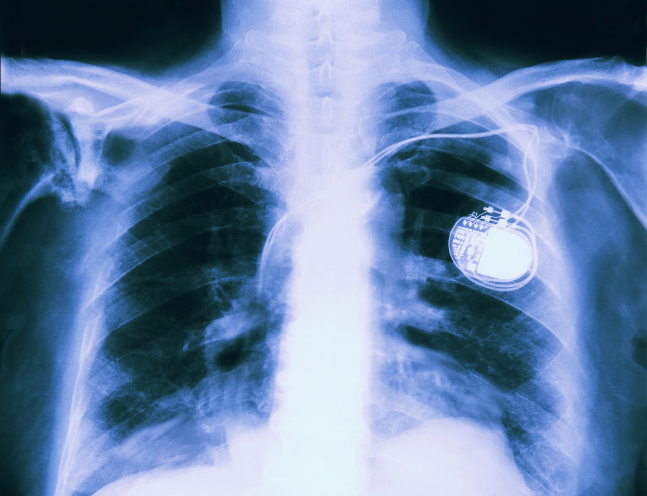 Computerized bodies need privacy