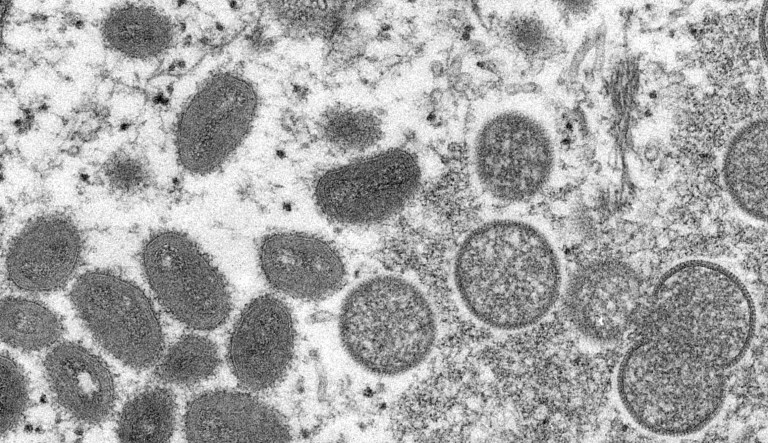 This electron microscopic (EM) image depicted a monkeypox virion, obtained from a clinical sample associated with the 2003 prairie dog outbreak.