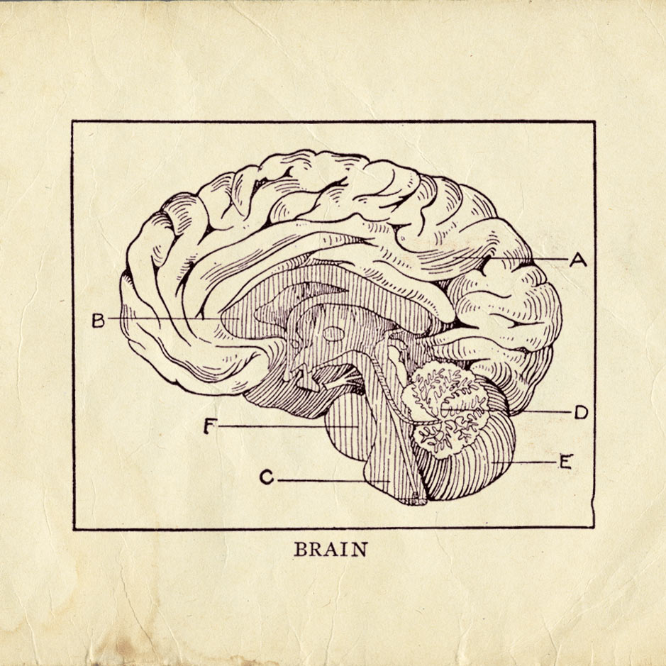 Surprise and Creativity