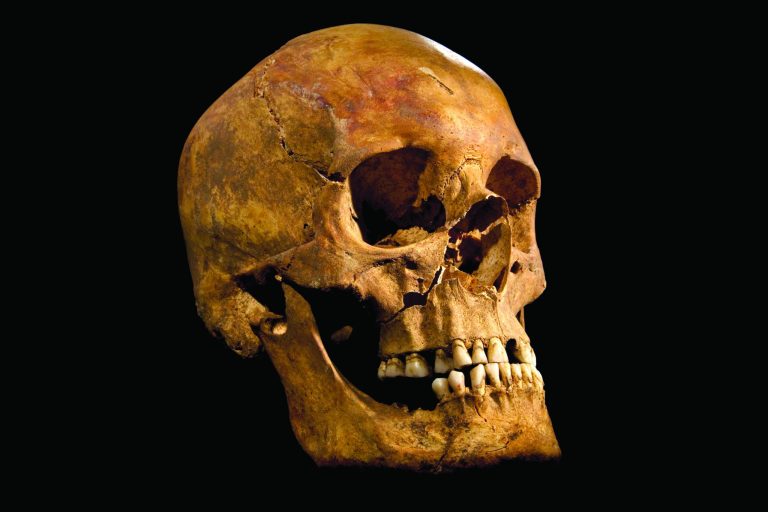 Undated photo made available by the University of Leicester, England, Monday Feb. 4 2013 of the skull found at the Grey Friars excavation in Leicester, potentially the long lost remains of England's King Richard III, ahead of an announcement about the identity of the skeleton found underneath a car park last September. Richard was immortalized in a play by Shakespeare as a hunchbacked usurper who left a trail of bodies -- including those of his two young nephews, murdered in the Tower of London -- on his way to the throne. (AP Photo/ University of Leicester)