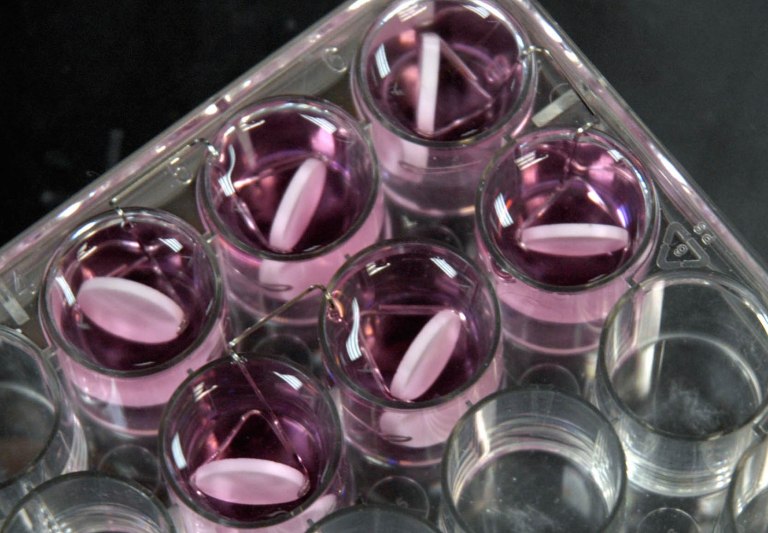 The next frontier in fighting drug-resistant superbugs. Instead of trying to directly kill germs, the new goal is to disable bacteria's ability to sicken in the first place. (AP Photo/Kevin Rivoli)