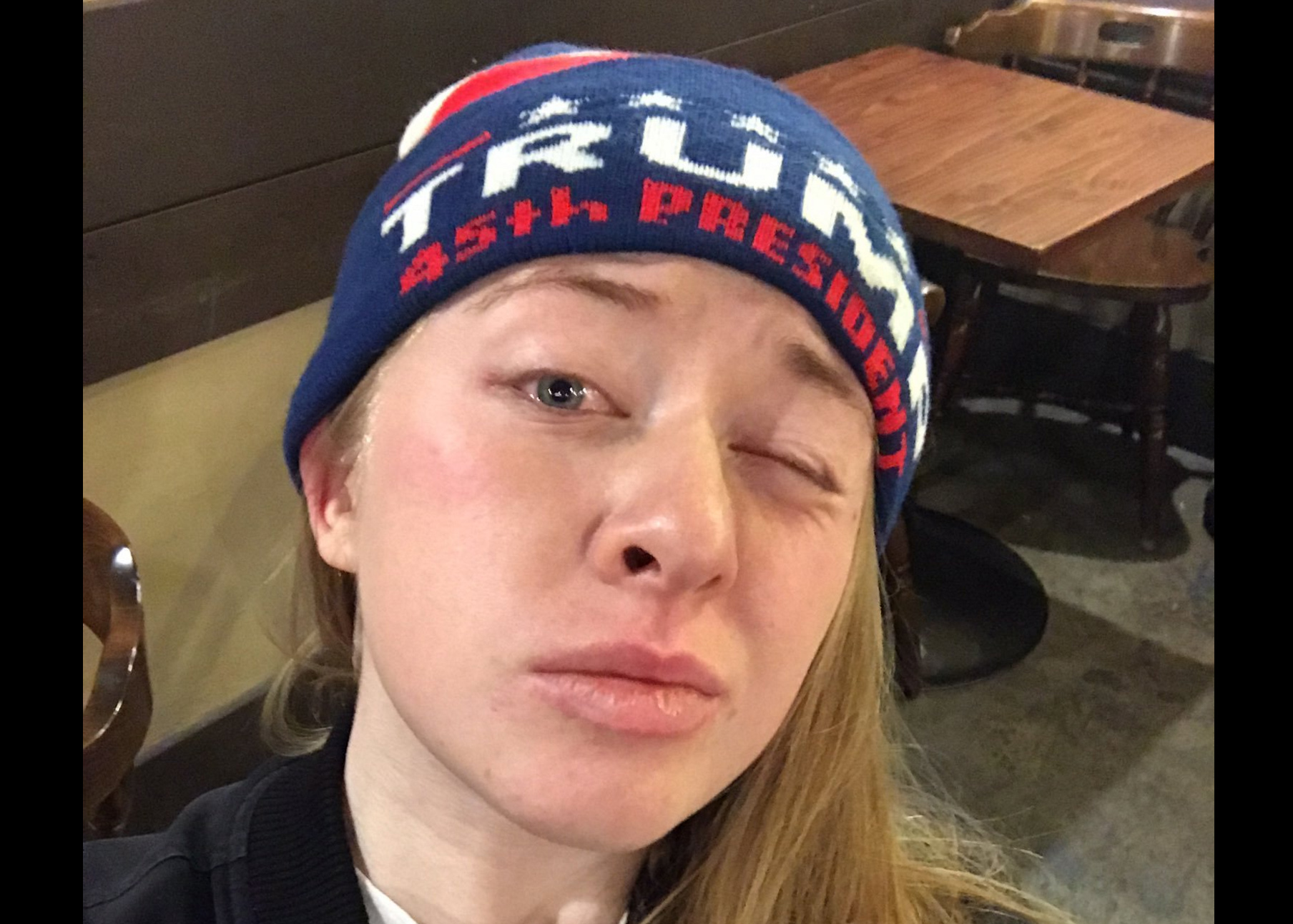 Berkeley Trump supporter who was pepper sprayed during protests sues the university and others for $23 million