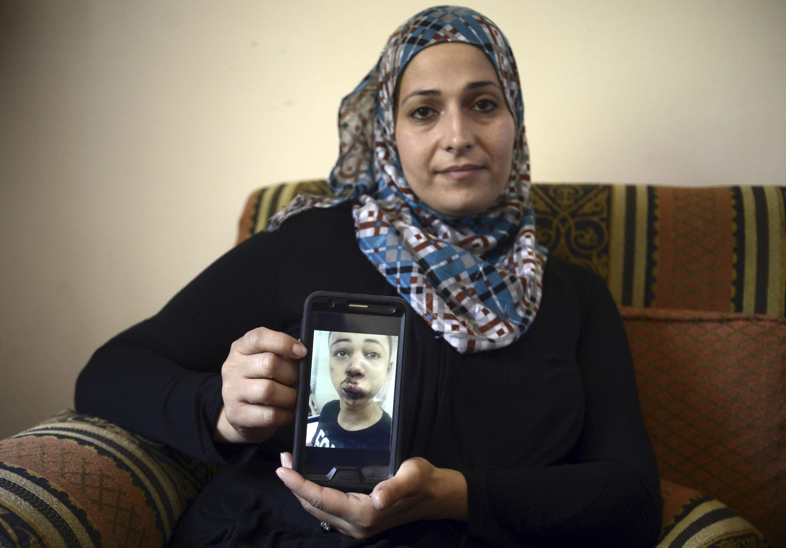 Palestinian teen burned to death, autopsy shows