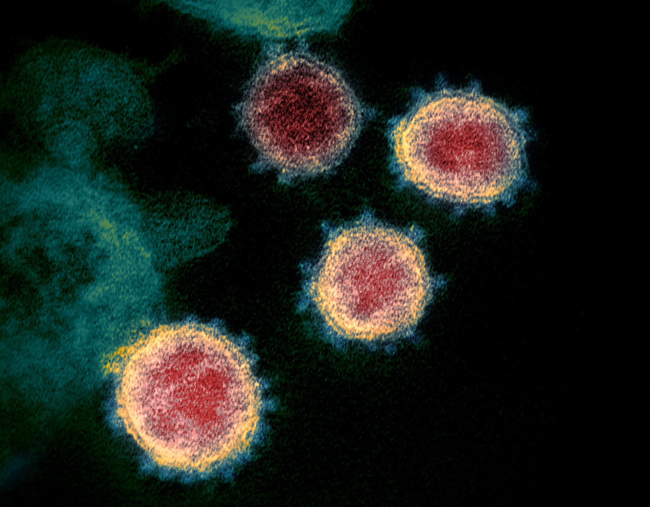 US flying blind with coronavirus variants