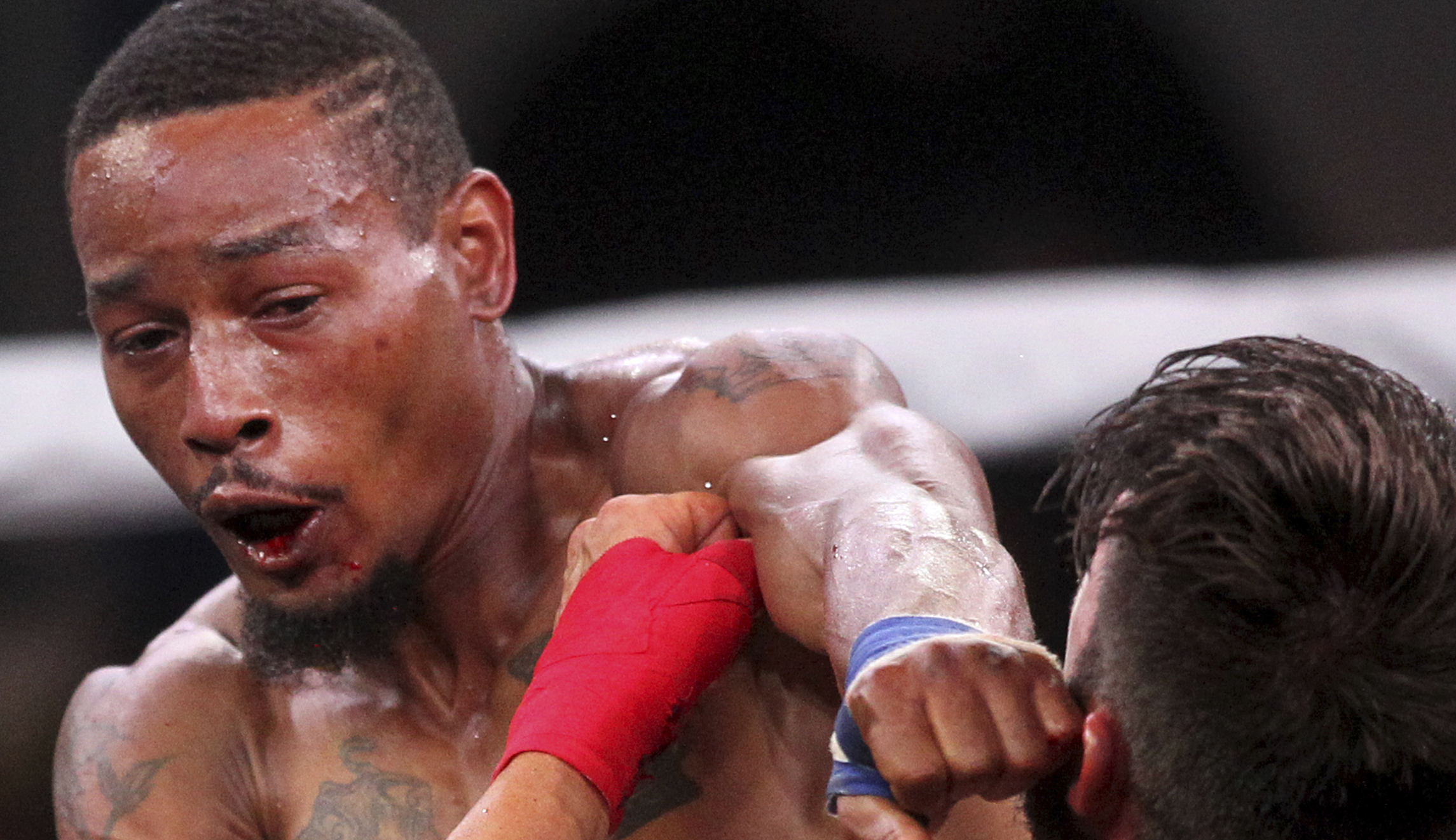 Bare-knuckle boxing is safer than using gloves, so why is it widely illegal?