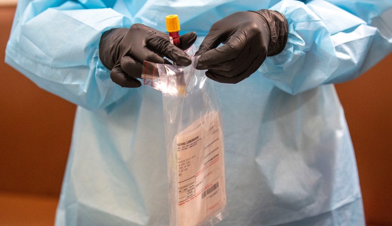 UK study shows COVID-19 patients likely immune for half a year