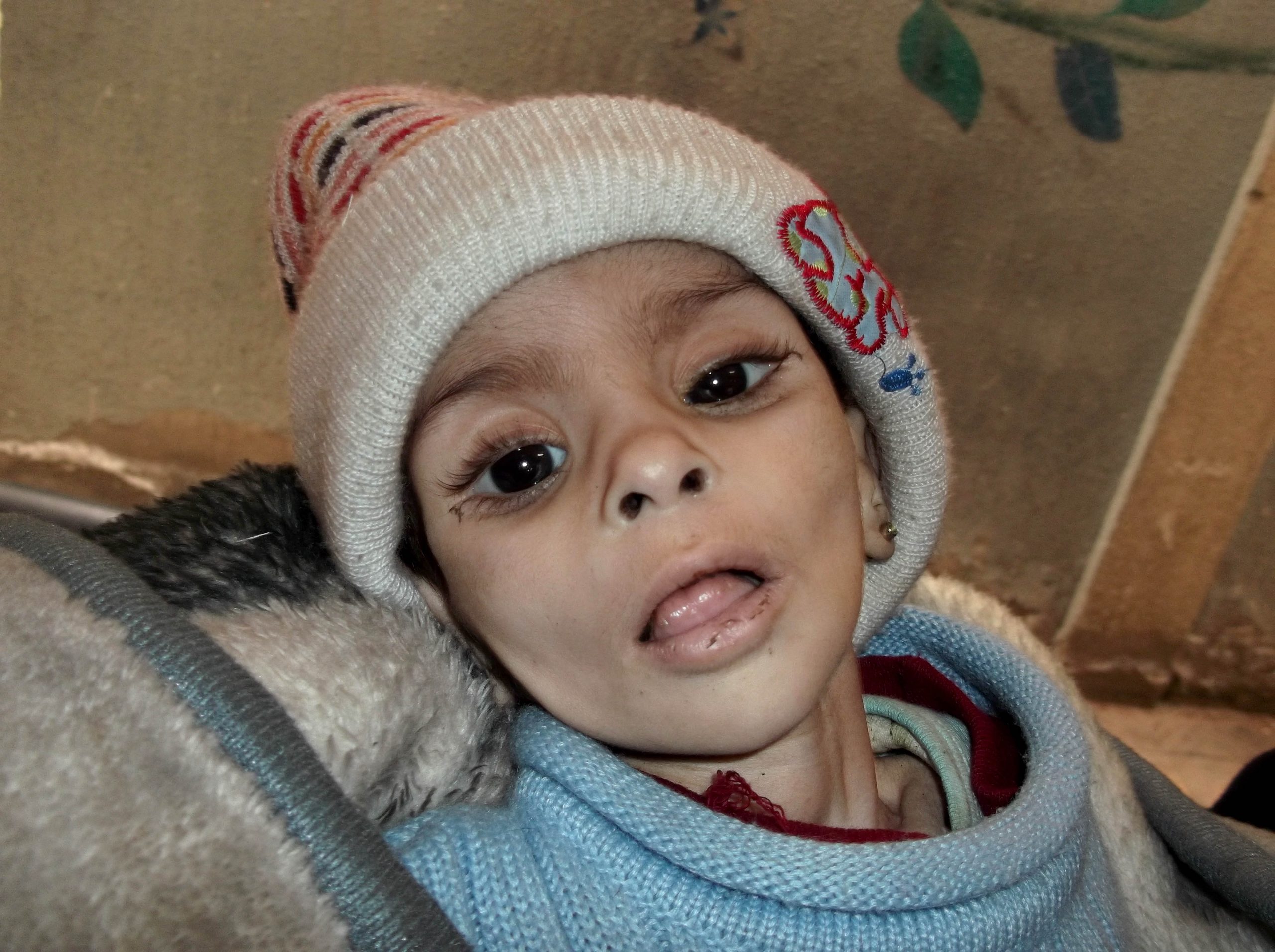 UN: Palestinians in Syrian camp are ‘traumatized’