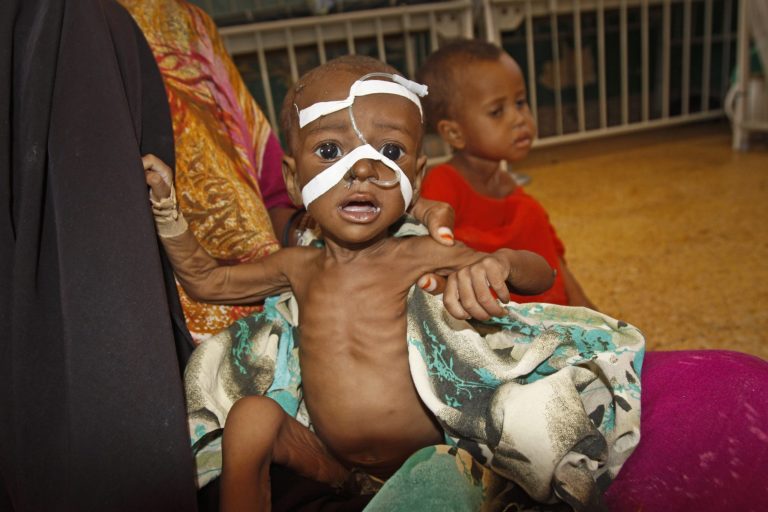 FILE - In this Tuesday, May 20, 2014 file photo, Mohamed Aden, a malnourished two-year-old boy, sits on his mother's lap at Banadir maternal hospital in Mogadishu, Somalia. Residents and officials say that severe hunger is spreading in southern Somalia where Islamic militants have encircled several towns in the control of African Union forces, preventing food deliveries, and deaths from malnutrition and hunger have been reported. (AP Photo/Farah Abdi Warsameh, File)