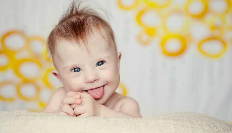 What Iceland is really doing is perpetuating the abhorrent eugenics philosophy of eliminating 