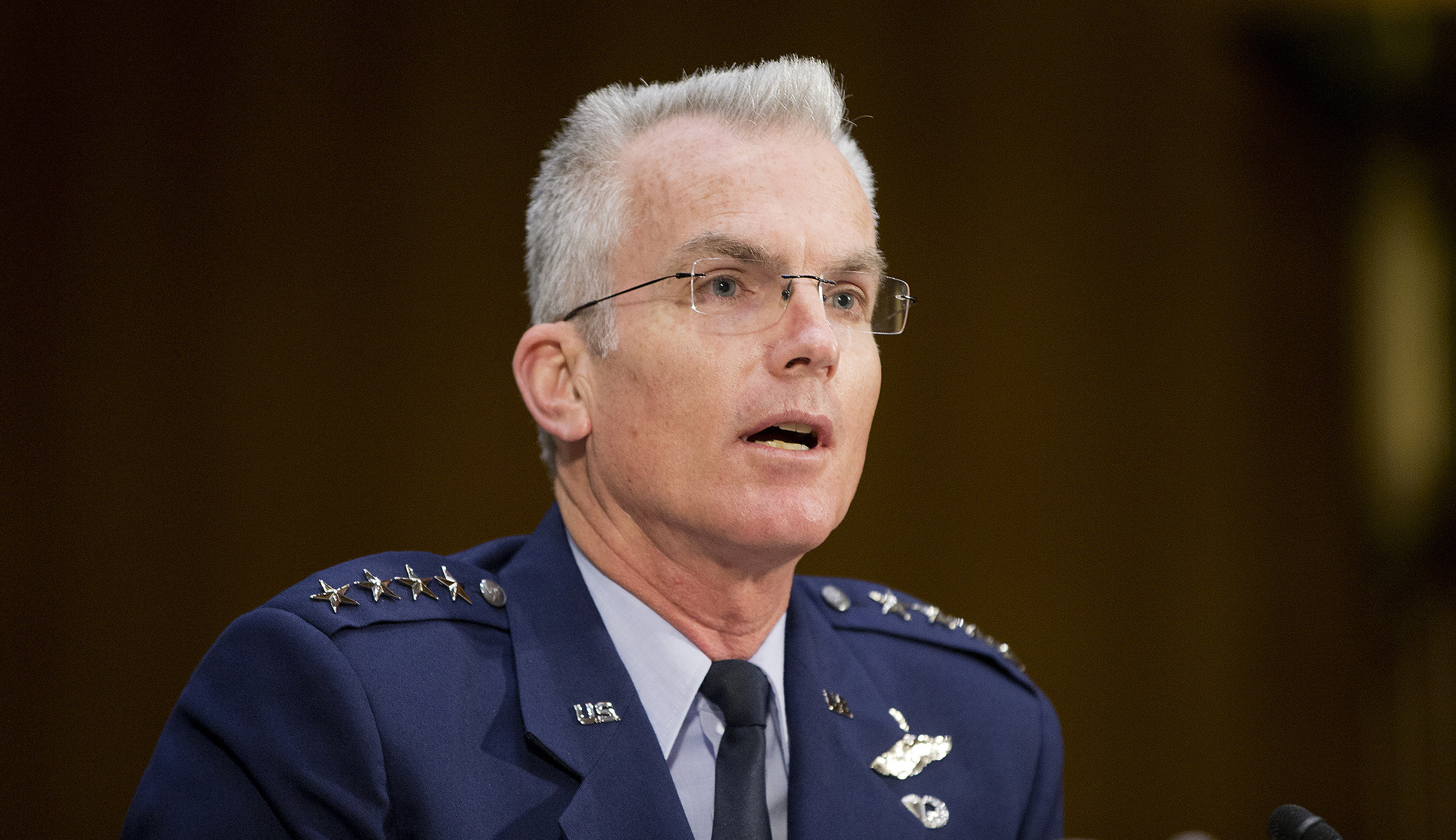 Military brass split over science of transgender treatment, general says