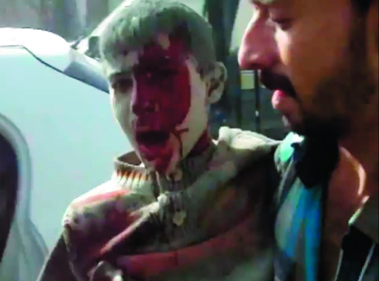This image taken from video obtained from Shaam News Network, which has been authenticated based on its contents and an Associated Press journalist who saw a plane bomb an area around the Syrian-Turkish border town of Ras al-Ayn, shows a wounded Syrian youth being placed in a car moments after an airstrike by Syrian warplanes in Ras al-Ayn, Syria, Monday, Nov. 12, 2012. (AP Photo/Shaam News Network via AP video)