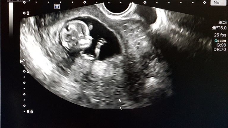 Utah’s prenatal child support law is holistically pro-life