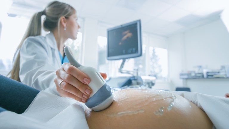A pregnant woman receives an ultrasound.
