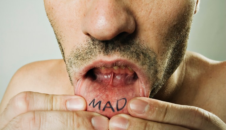 Young man with the word "MAD" in his lips.
