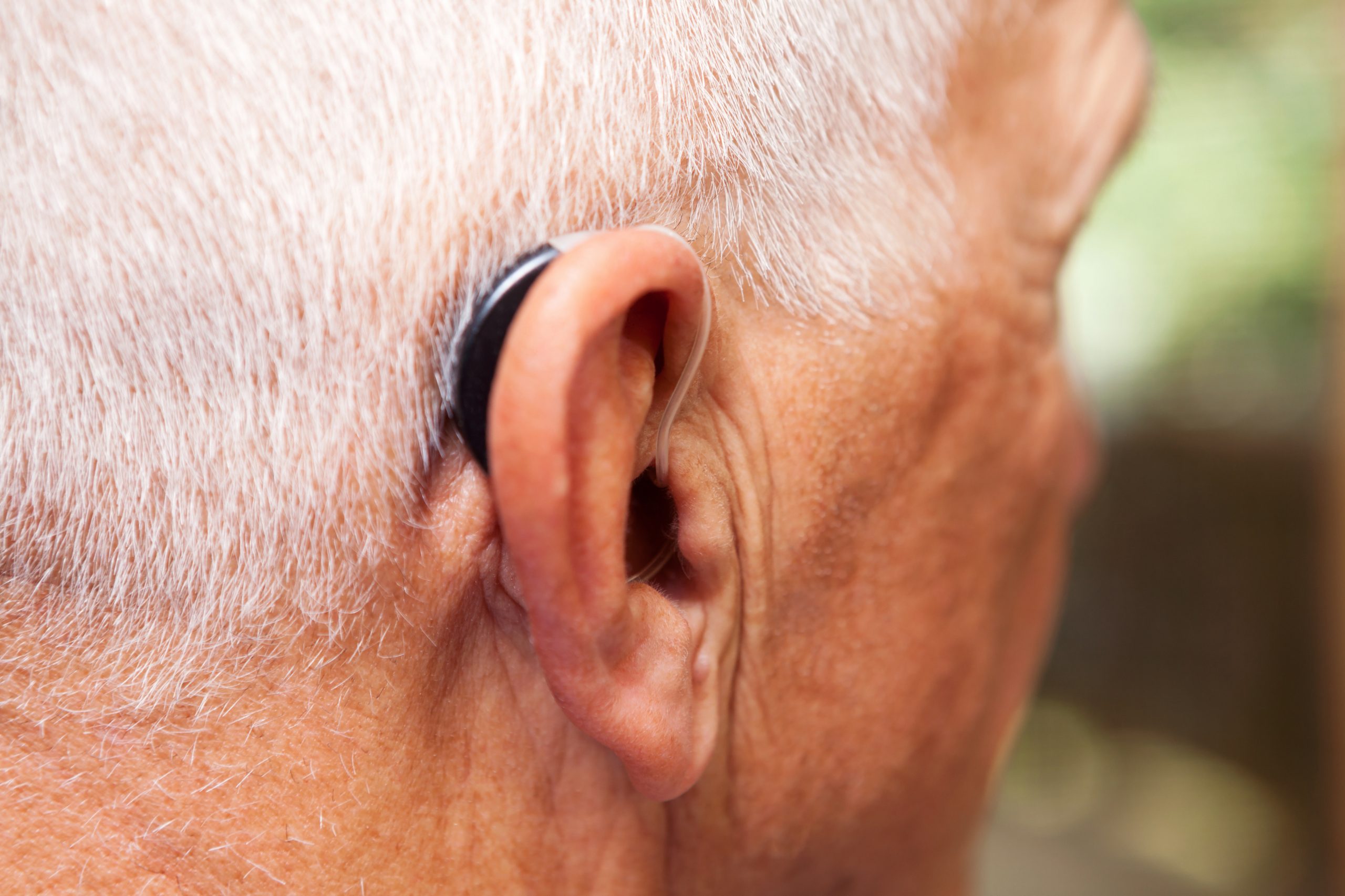 Affordable hearing aids should be a bipartisan issue