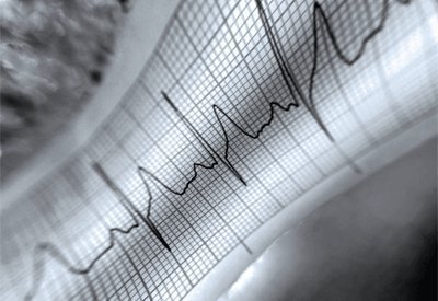 Health care reforms could cost 20 million their work coverage