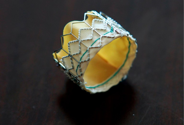   FILE-This Tuesday, Sept. 21, 2010, file photo, shows a model of a minimally invasive heart valve by Edwards Lifesciences Corp. in Washington. The Food and Drug Administration said Monday, June 11, 2012, that the heart valve compared favorably to surgery after one year, with patients living about the same amount of time. However, reviewers said patients who got the Sapien valve had a higher rate of stroke in the month after the procedure. Additionally, more than half of patients had leaking from the aortic heart valve, a potentially dangerous condition in which blood flows backward into the heart's ventricle chamber. (AP Photo/Jacquelyn Martin, File)  