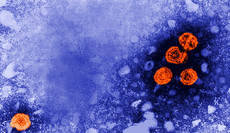 Health officials raise alarm about mysterious hepatitis cases in children