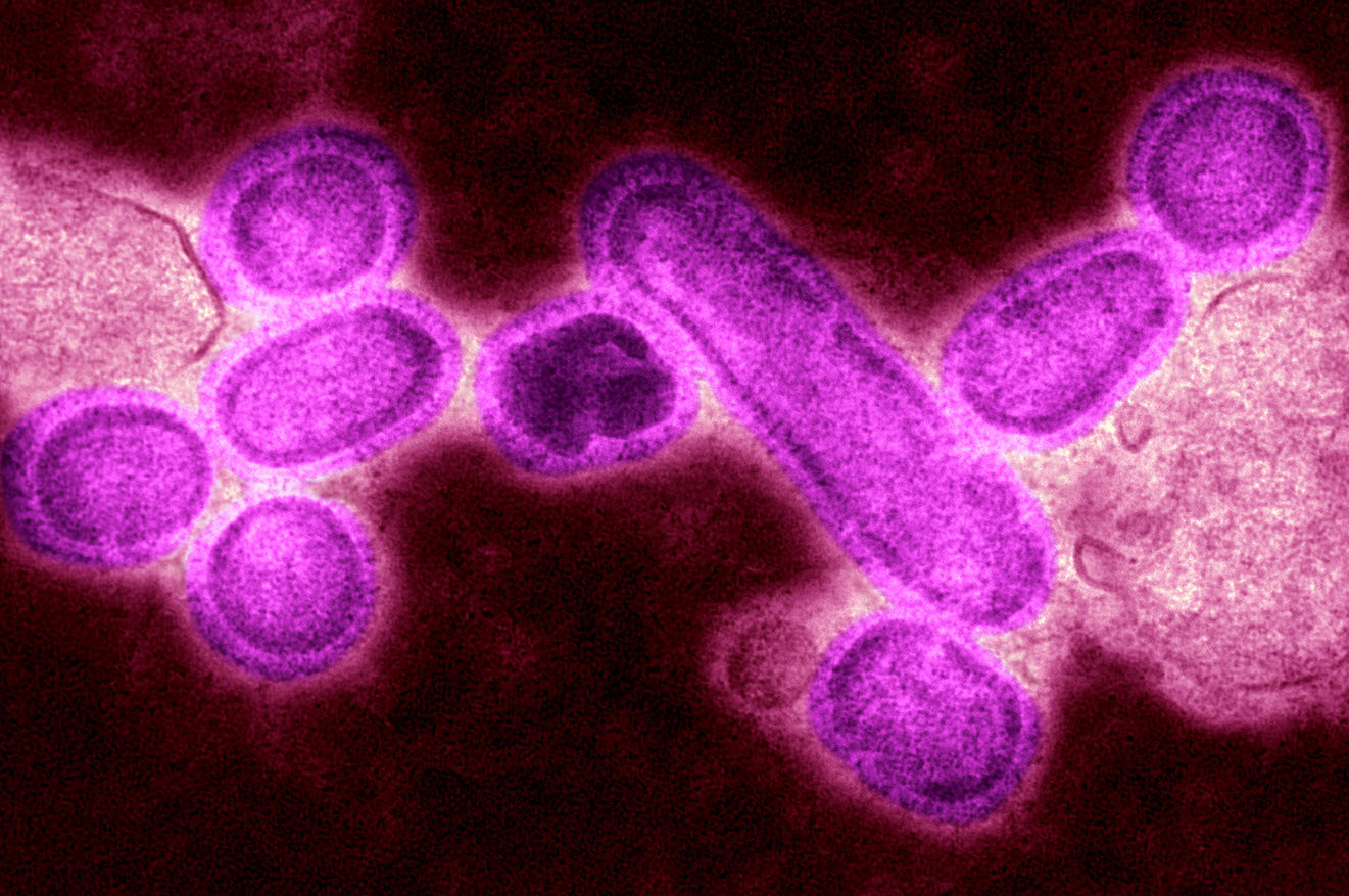 A Flu Pandemic Is In Our Future. Time to Read ‘The Stand.’