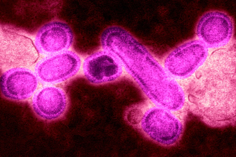 A Flu Pandemic Is In Our Future. Time to Read ‘The Stand.’