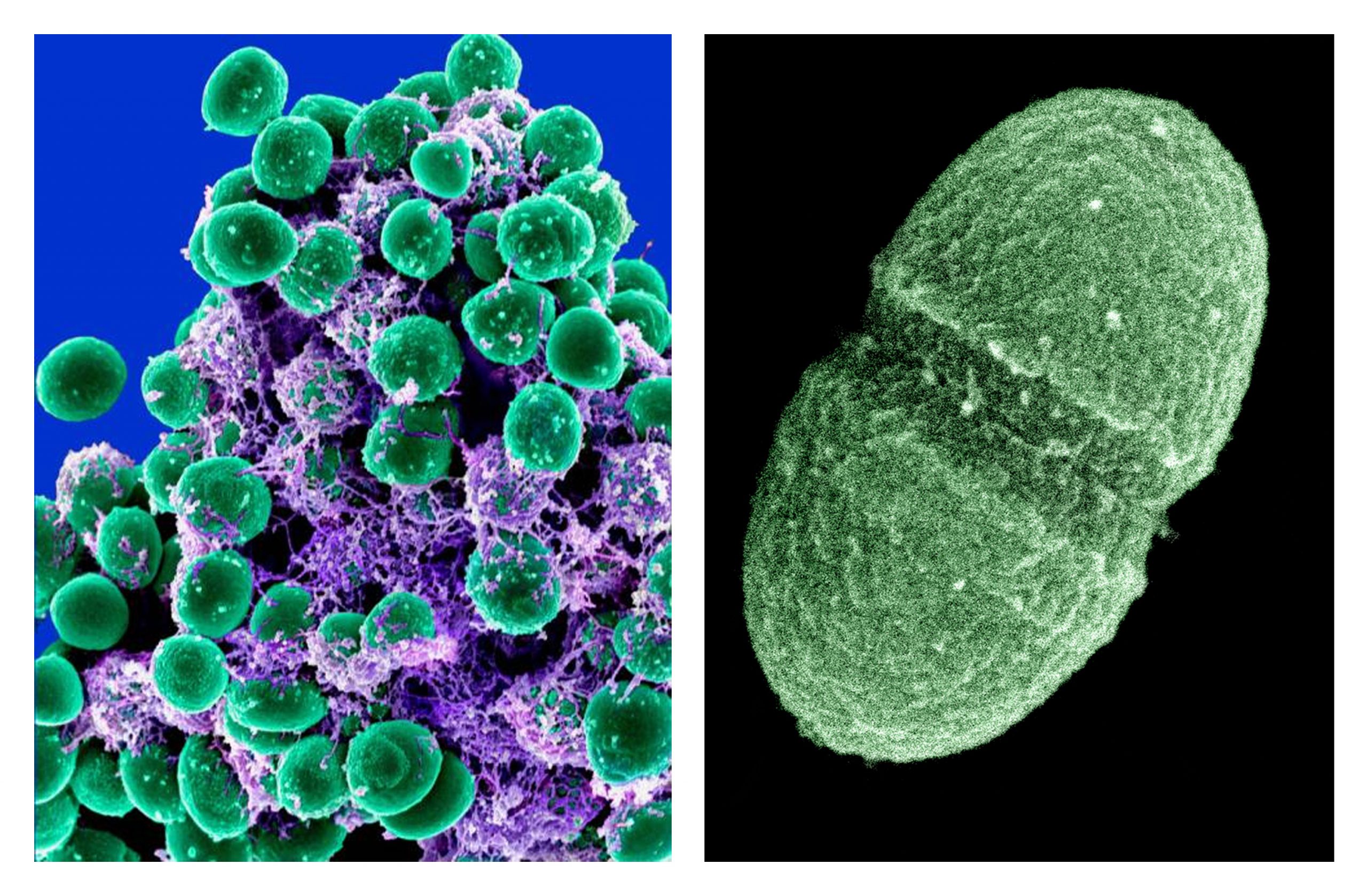 10,000 germ species live in and on healthy people