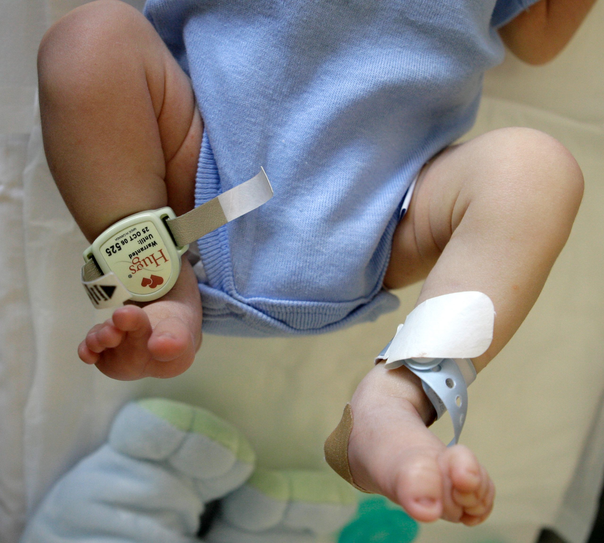Australian researchers find possible biomarker for SIDS