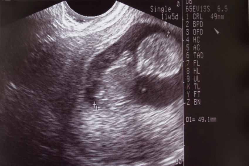 New Hampshire Republican Party adds ‘personhood’ to official platform
