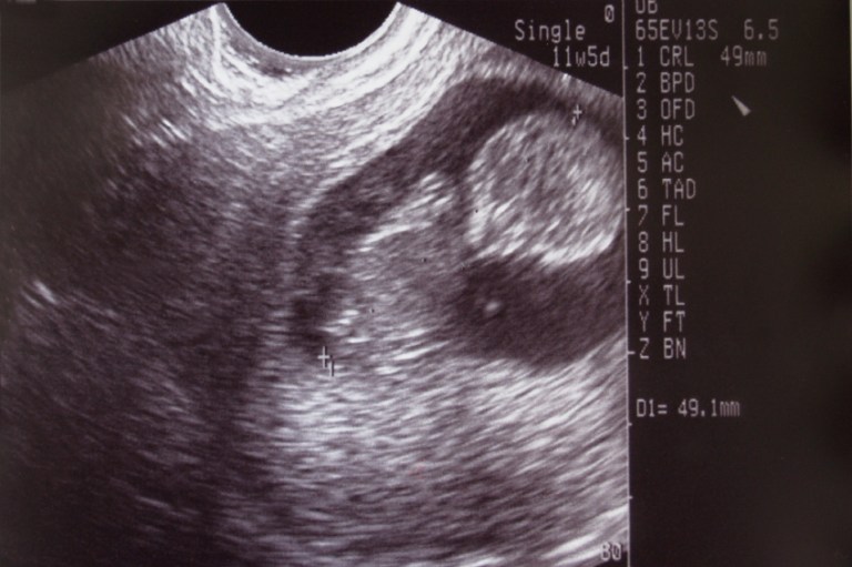 The platform now states: 