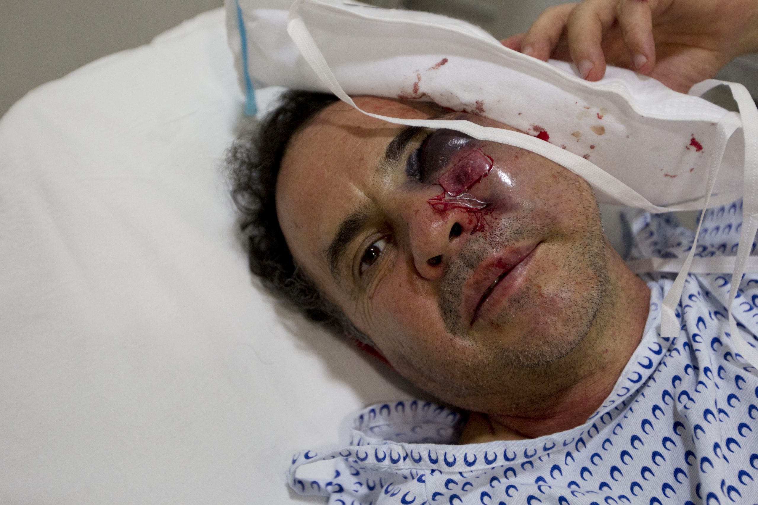 Mexico protesters attack journalists, smash glass