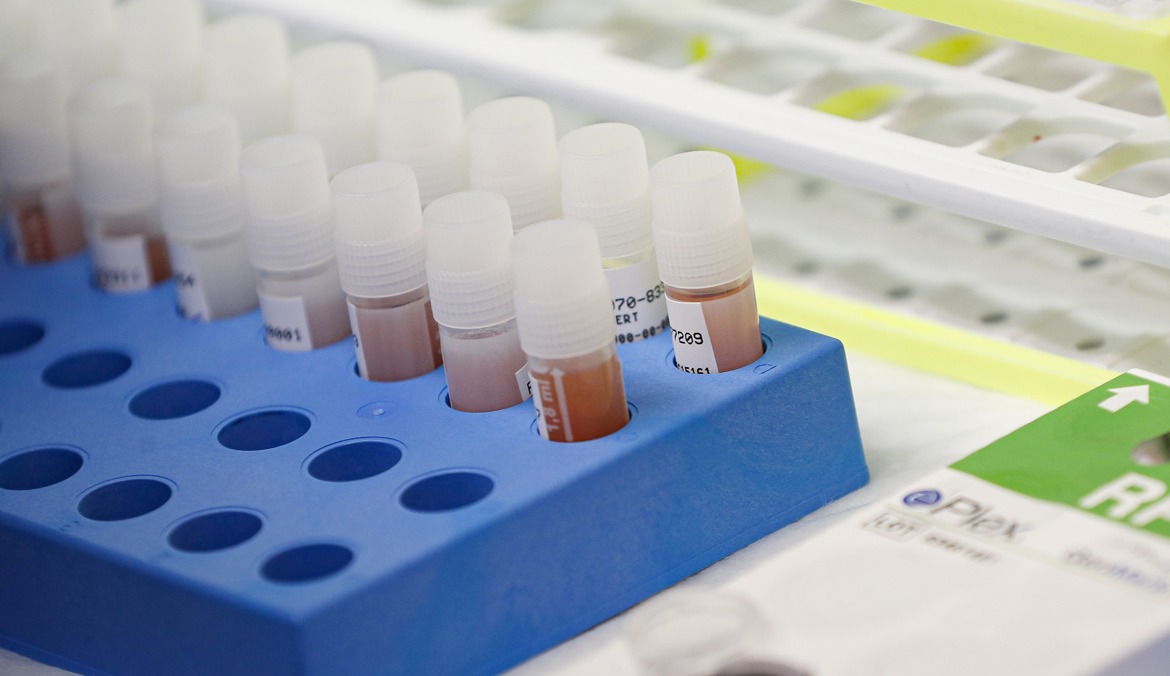 How to make coronavirus testing available and efficient