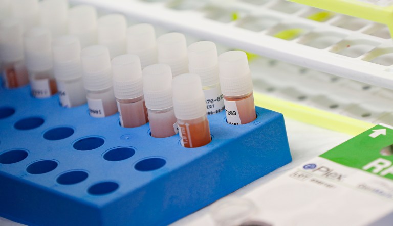 How to make coronavirus testing available and efficient