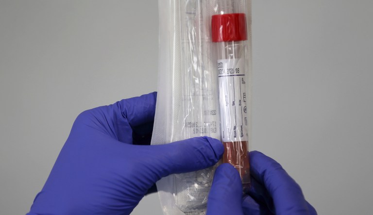 ‘Historic moment’: Company plans to produce millions of 5-minute coronavirus tests