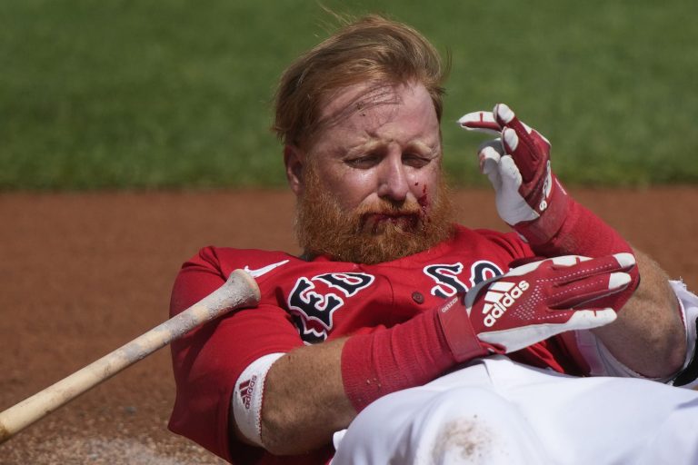Boston Red Sox Justin Turner reacts after being hit in the face on a pitch by Detroit Tigers starting pitcher Matt Manning in the first inning of their spring training baseball game in Fort Myers, Florida, on Monday, March 6, 2023.
