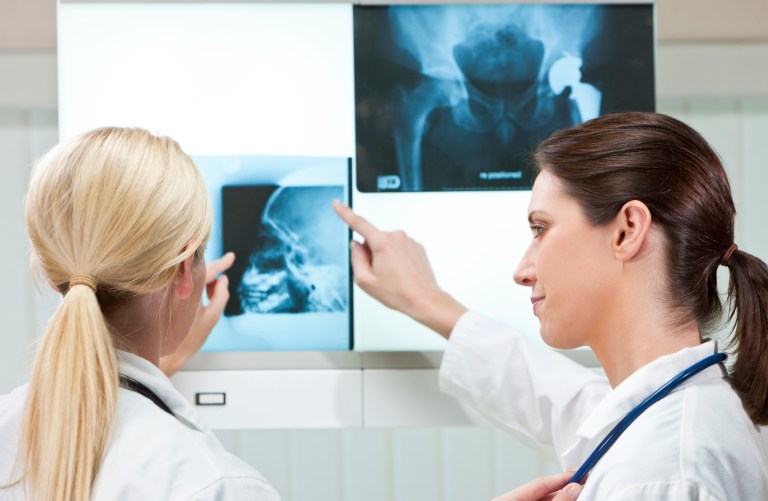 Major joint replacement accounted for $6.6 billion in Medicare payments in fiscal 2013, according to new Medicare data released Monday.Â (iStock)