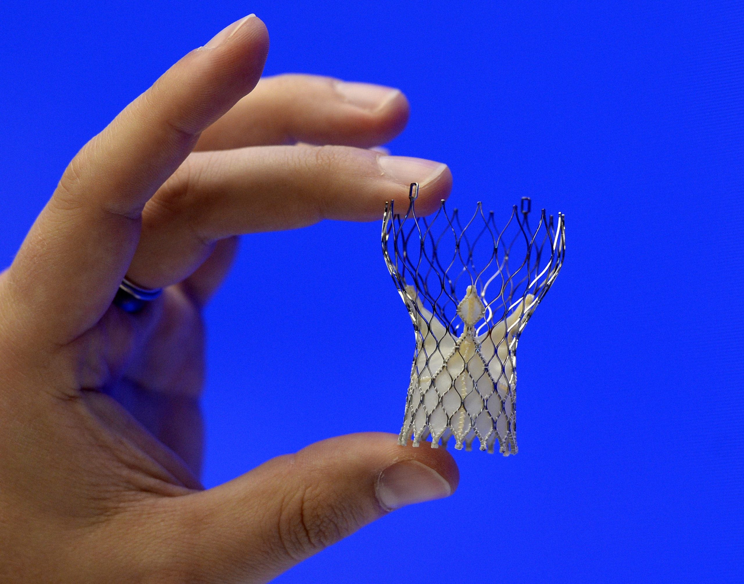 Study backs nonsurgical way to fix heart valves