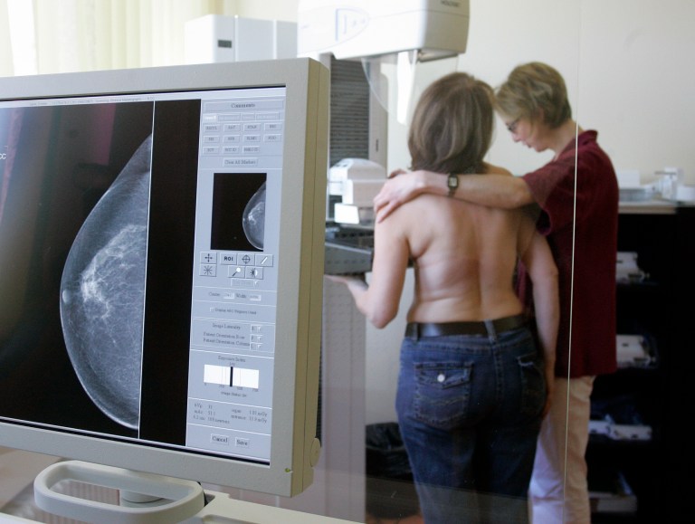 Mammograms may cut breast cancer deaths by 28%