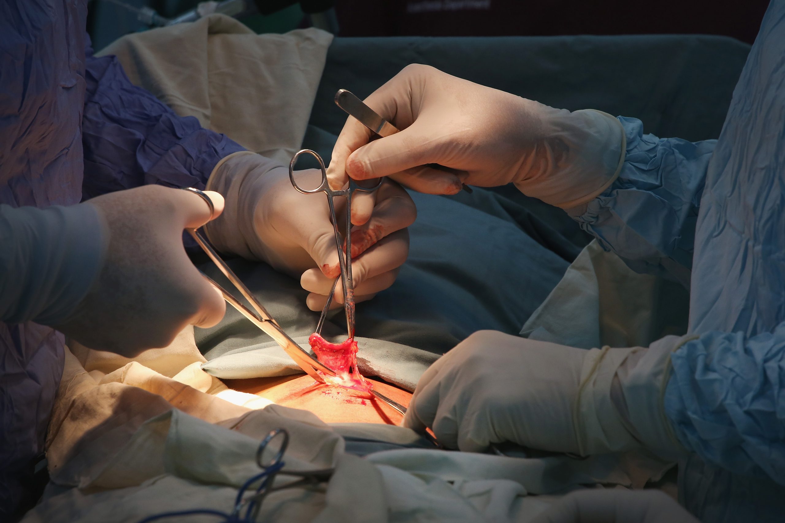 Patient died after VA doc and resident wife did unneeded procedure; then doc was promoted