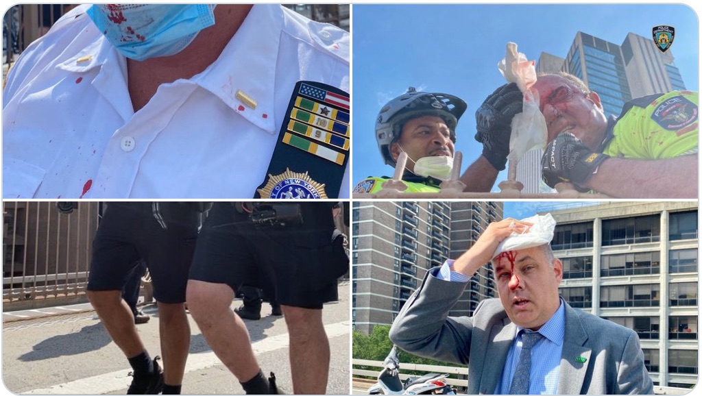 Injured New York Police Department officers are seen at dueling police-related protests.