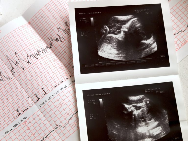 Pro-life advocates urge HHS to stop funding research on remains of aborted children