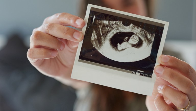 Professor who compared fetuses and cancers tries to explain