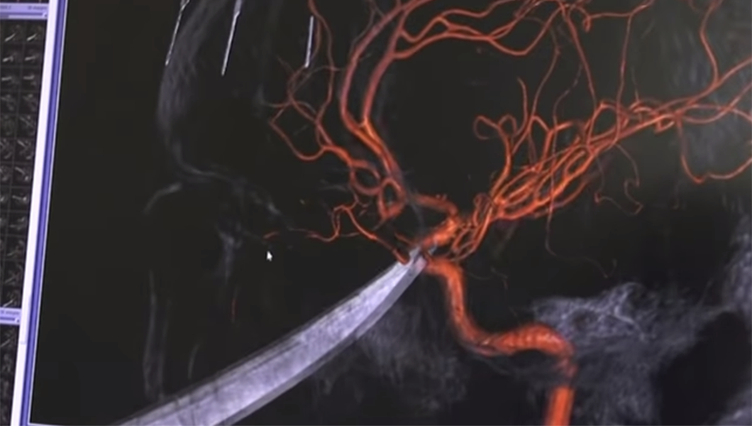 ‘It’s amazing’: Boy survives after 10-inch knife lodged in his skull
