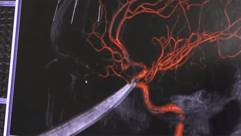 ‘It’s amazing’: Boy survives after 10-inch knife lodged in his skull