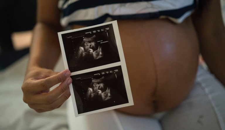 Isabela Cristina, 18, who is six months pregnant, shows a photo of her ultrasound. (AP Photo/Felipe Dana)
