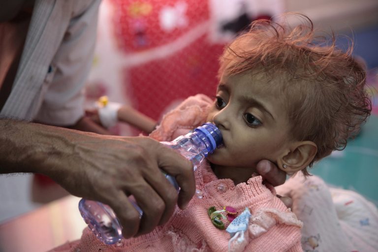 A father gives water to his malnourished daughter at a feeding center in a hospital in Hodeida, Yemen. With US backing, the United Arab Emirates and its Yemeni allies have restarted their all-out assault on Yemenâs port city of Hodeida, aiming to wrest it from rebel hands. Victory here could be a turning point in the 3-year-old civil war, but it could also push the country into outright famine. Already, the fighting has been a catastrophe for civilians on the Red Sea coast. 