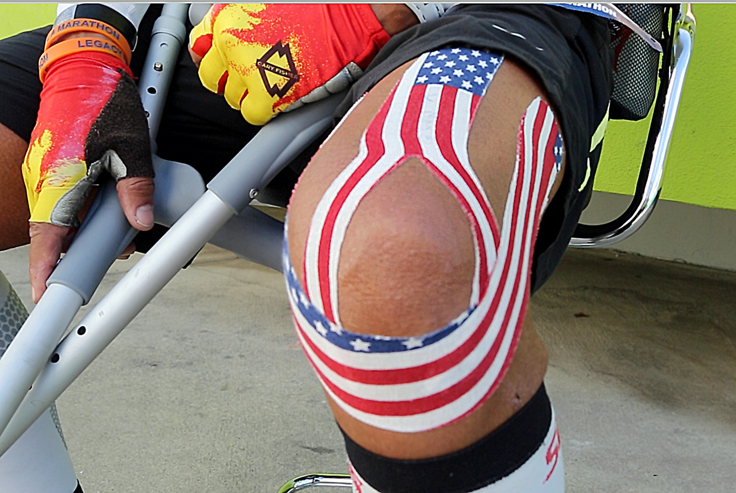 Payments for joint replacements would be based on quality