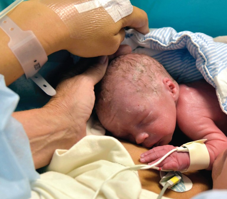 In this photo provided by the Lancet, the world's first baby born to a woman with a transplanted womb, is shown after his birth in Goteborg, Sweden. For the world's first baby born to a woman with a transplanted womb, only a victorious name would do. His mother says that is why his parents named him 