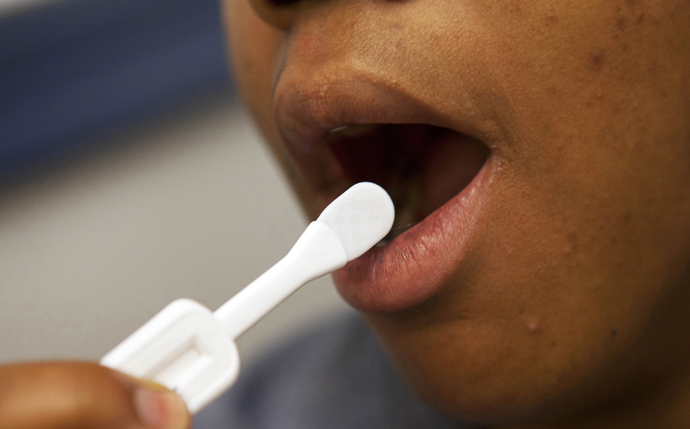 Demolish AIDS with home HIV tests