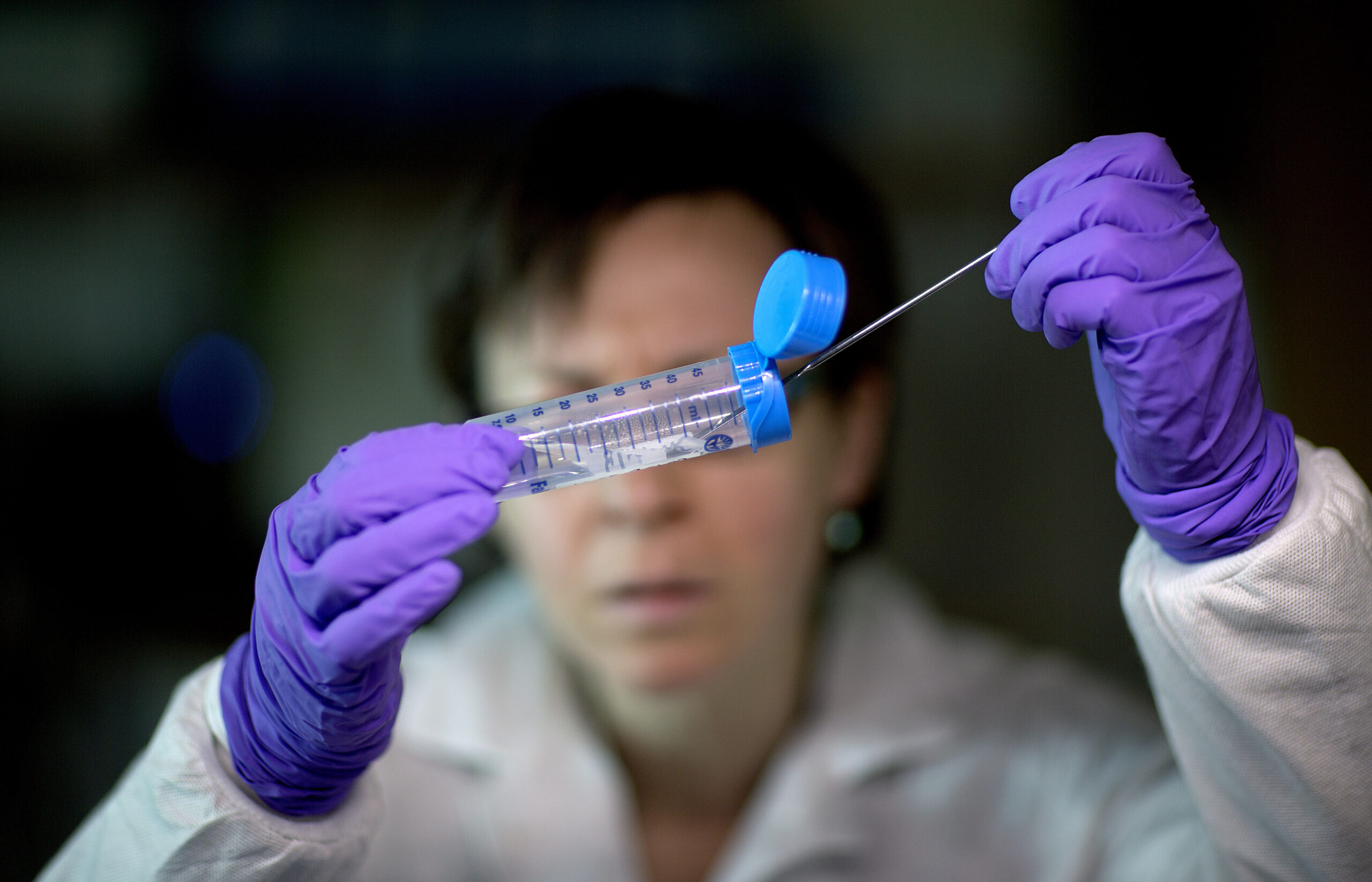 Experts decode germs’ DNA to fight food poisoning