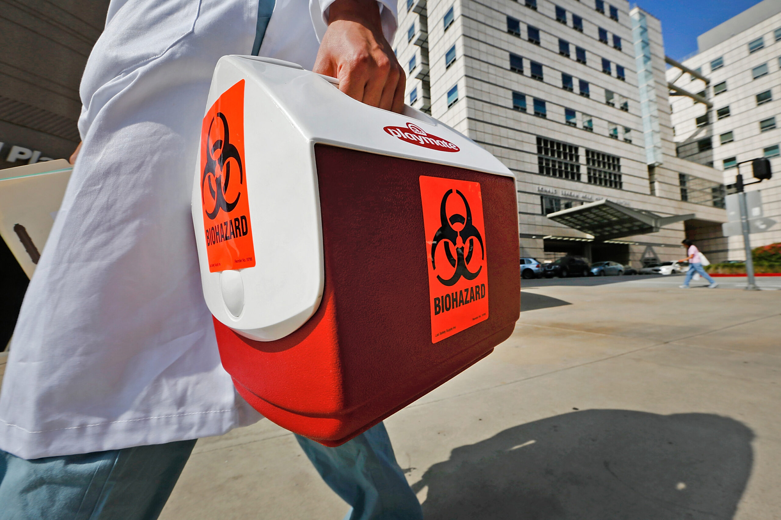 California has second outbreak of deadly superbugs