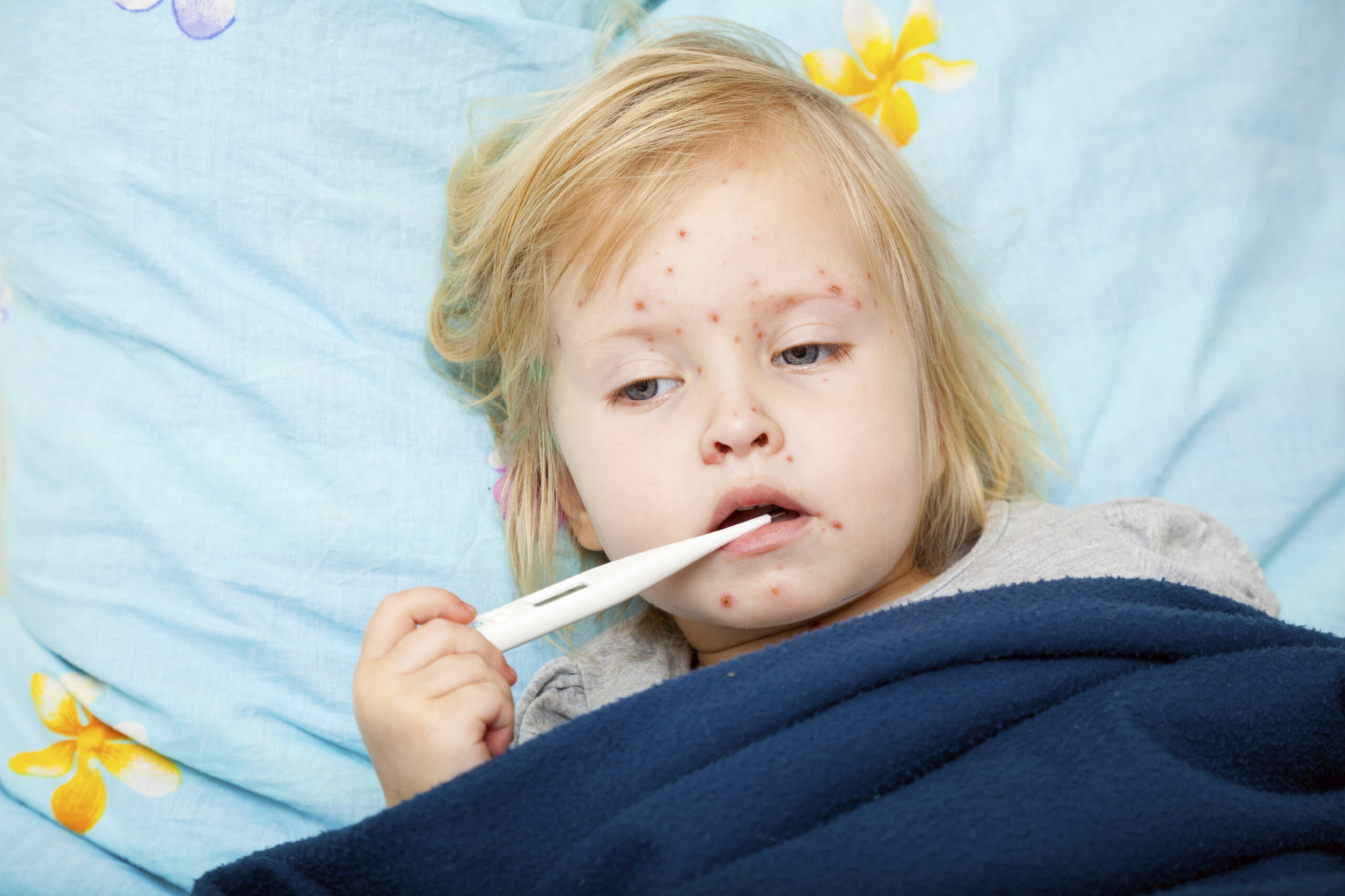 20 new measles cases appear nationwide